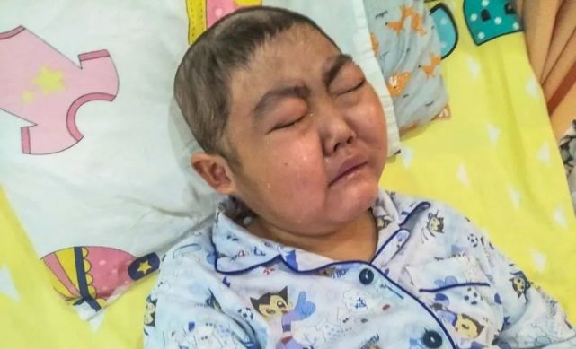 12岁男孩患世界罕见病曾辗转求医长达10年如今哭求放弃治疗