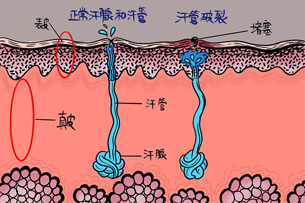 大汗腺全身分布图图片