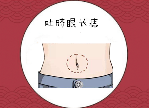 身上5颗福禄痣颗颗带福气一个升官一个生财千金不换