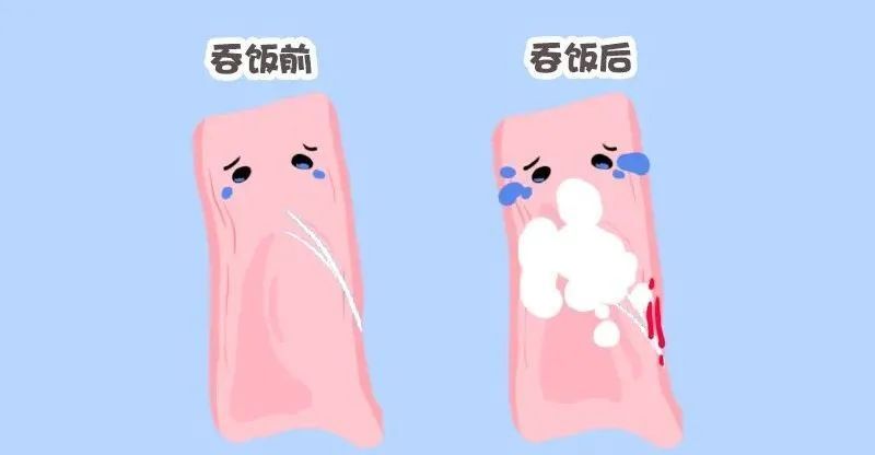 鼻子塞_塞鼻子流鼻涕是怎么回事_塞鼻子的药有哪些