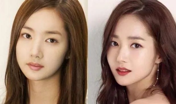 韩国第一"换头"女明星朴敏英,自曝整容7次,网友:真的很漂亮_腾讯新闻