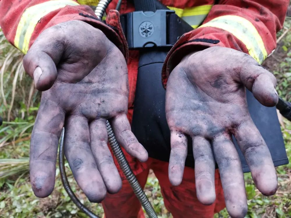 但是.:受伤也是难免的朋友圈里的照片:风和日丽,适合打球:要不要来?