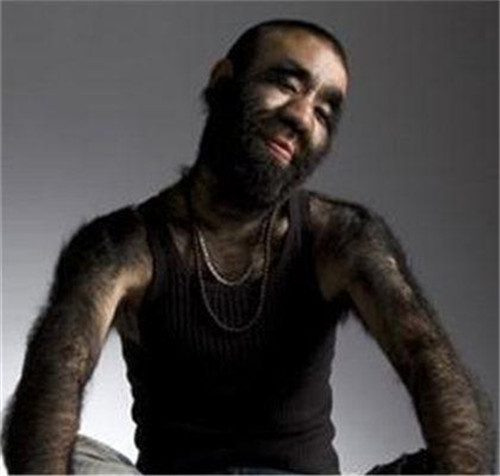 全世界体毛最长的女性曾创造世界纪录除全身毛后惊艳四方