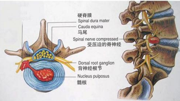 中醫如何解釋馬尾神經損傷出現下肢麻木的症狀