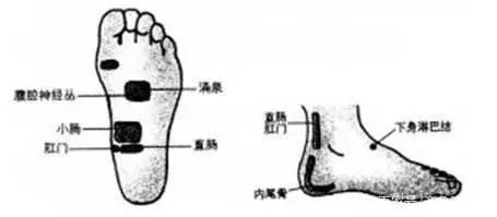 腳底這個部位睡前按壓可有效緩解痔瘡疼痛