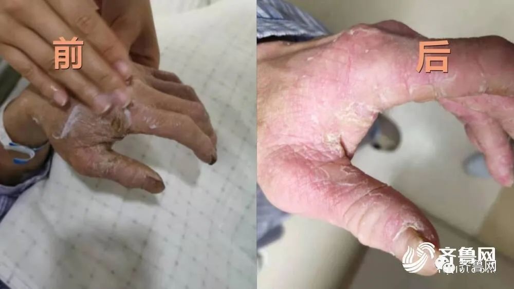 这两双手火了网友善良的人最美