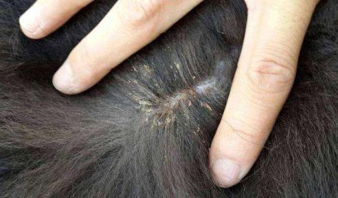 虮子的数量是远多于虱子的,而且是连在头发根上的,你要把它弄下来,就