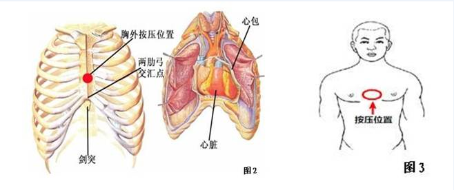 警惕!心脏猝死离年轻人越来越近