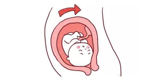 同时,左侧卧位可以减轻妊娠子宫对下腔静脉的压迫,增加回到心脏的血流