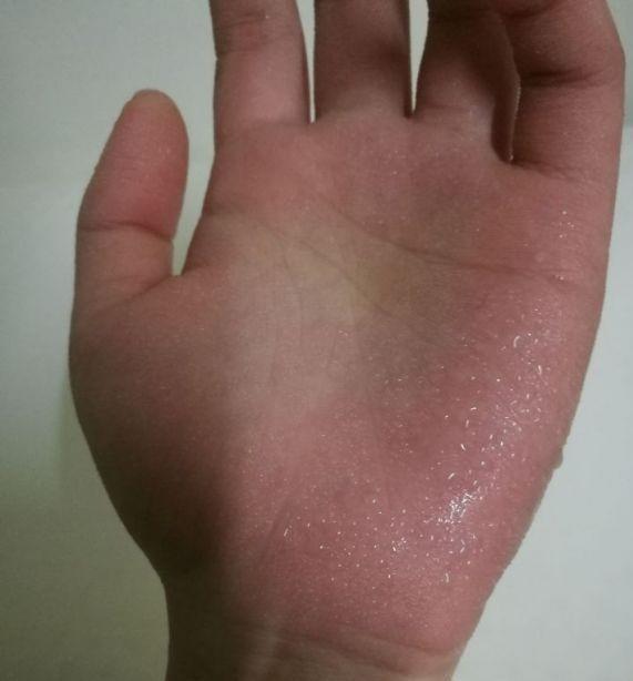 男人手心出汗什么原因