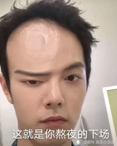 沙雕肖战晒搞怪自拍又开始玩自己五官了工作室失算了捡包袱捡早了