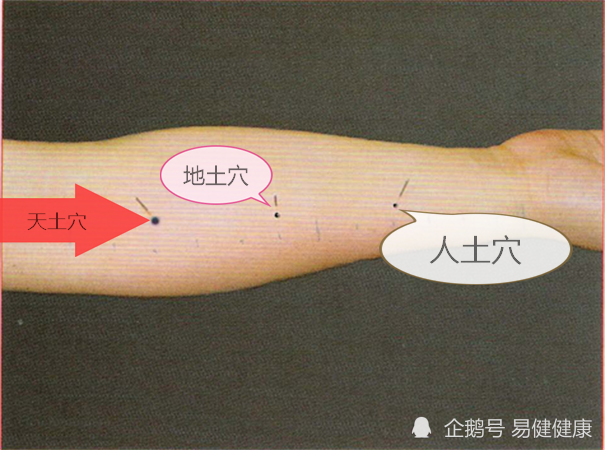 中医健康养生之人体手部穴位天士穴