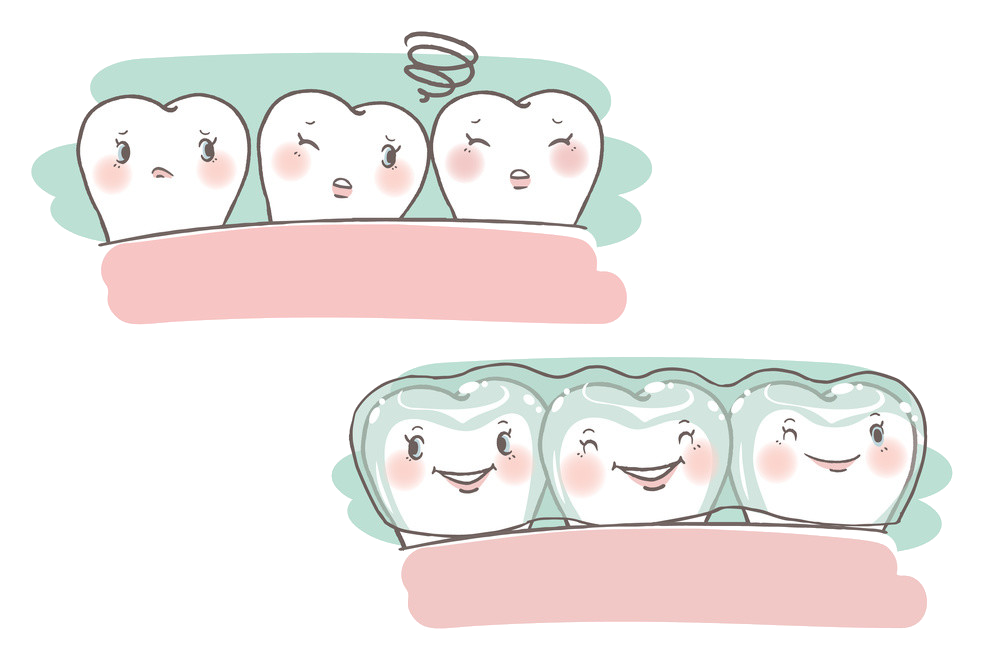 戴隐形牙套如何100分护理