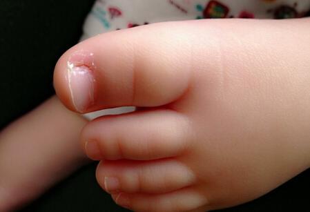 给宝宝剪指甲有讲究:这3种形状错了,很多父母都用第1种