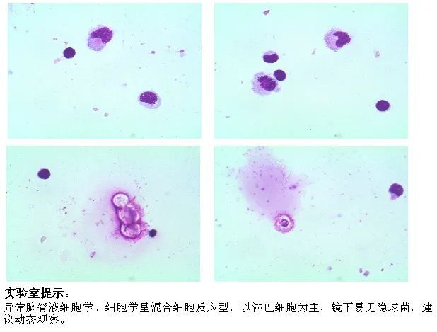 新型隐球菌负染色法图片