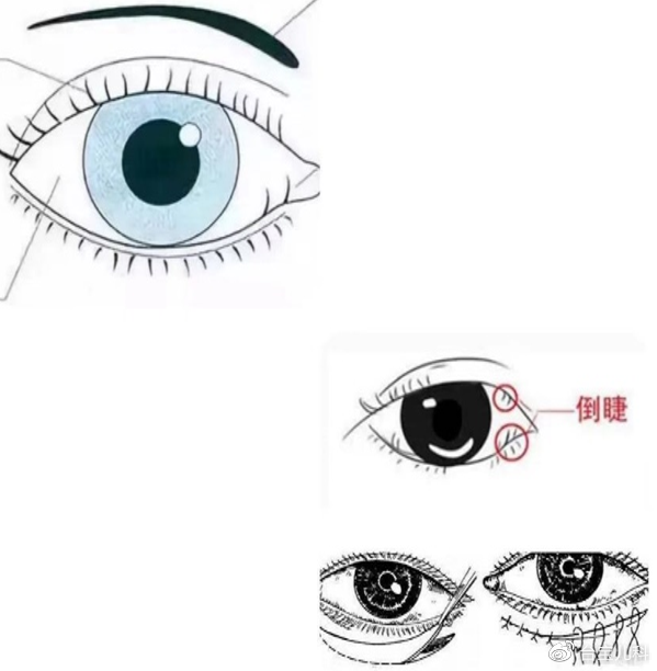 如果是婴幼儿由于脸部脂肪多,鼻梁骨未发育正常,睑缘相对较厚,睫毛也