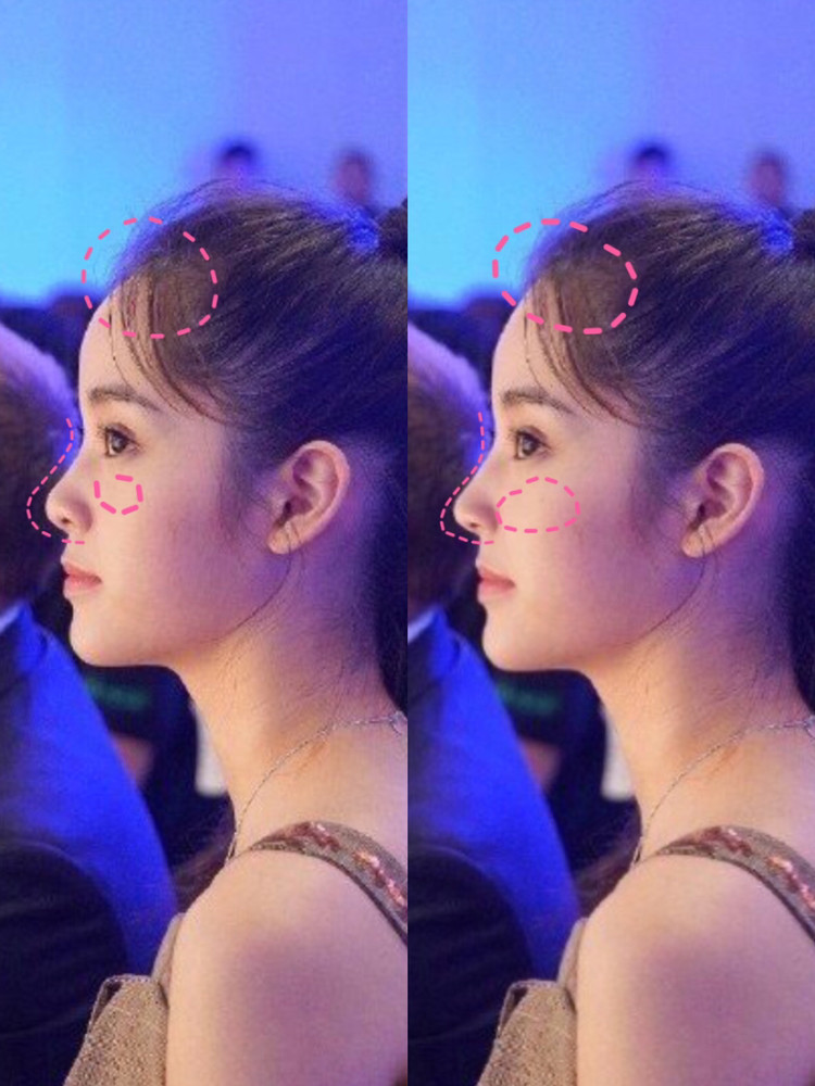 欧阳娜娜侧脸被嘲 正面美人也会有失误 腾讯新闻