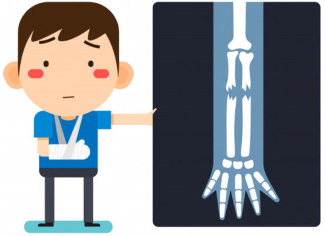 免疫杀手deepxray