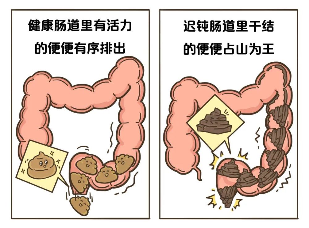 那些你沒拉出來的屎都去哪兒了健康日曆