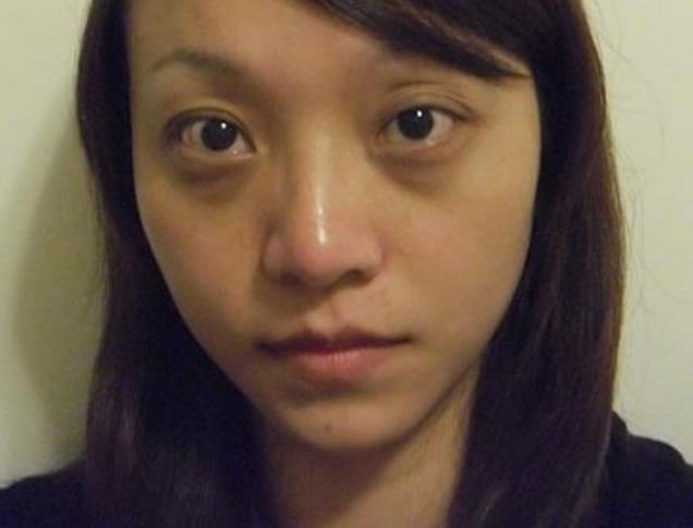 肝病不痛不痒,或许能从"脸色"看出来,注意这些表现及时检查