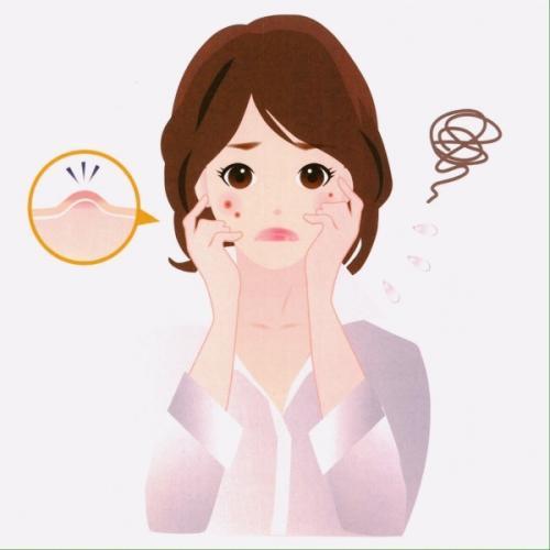 脸颊两边时常长痘痘怎么回事？