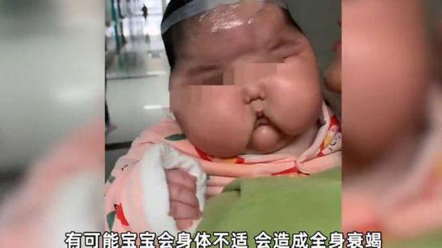 光明时评大头娃娃事件还没有画上句号