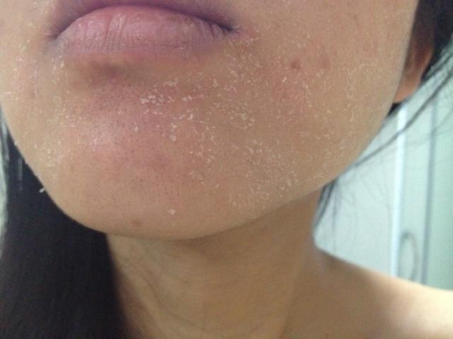 皮肤很干的时候补水,为什么会有刺痛感?_腾讯新闻