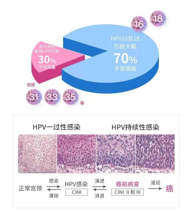 hpv只有女性才会感染吗