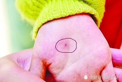 幼儿园3岁女童身上被扎29处针眼,是何原因导致,社会幼师虐童事件频发?