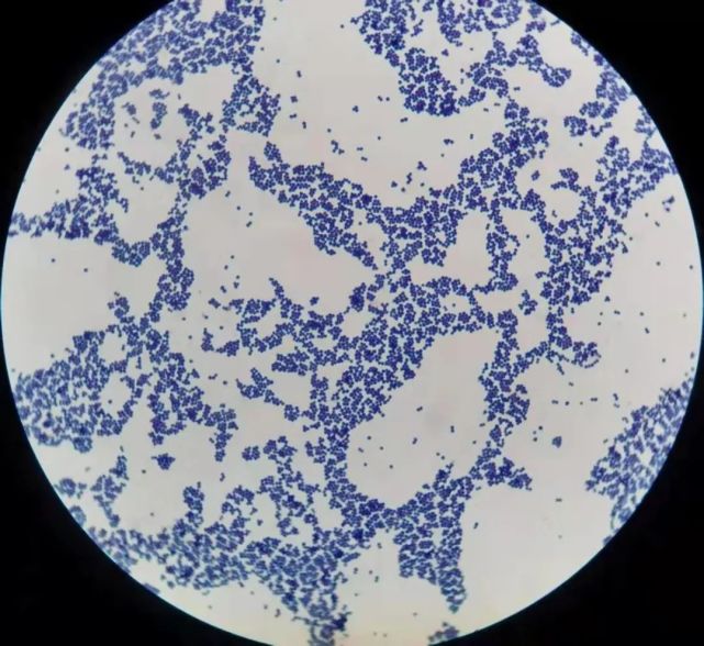 葡萄球菌显微镜下图片图片