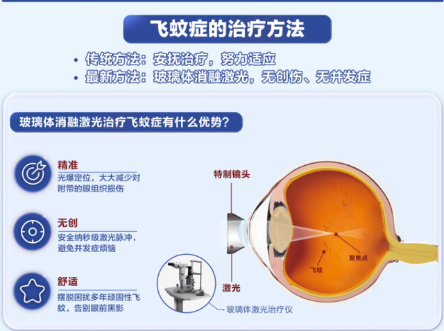 陈忠平主任介绍,"yag激光玻璃体消融术"是目前医院治疗飞蚊症的常用