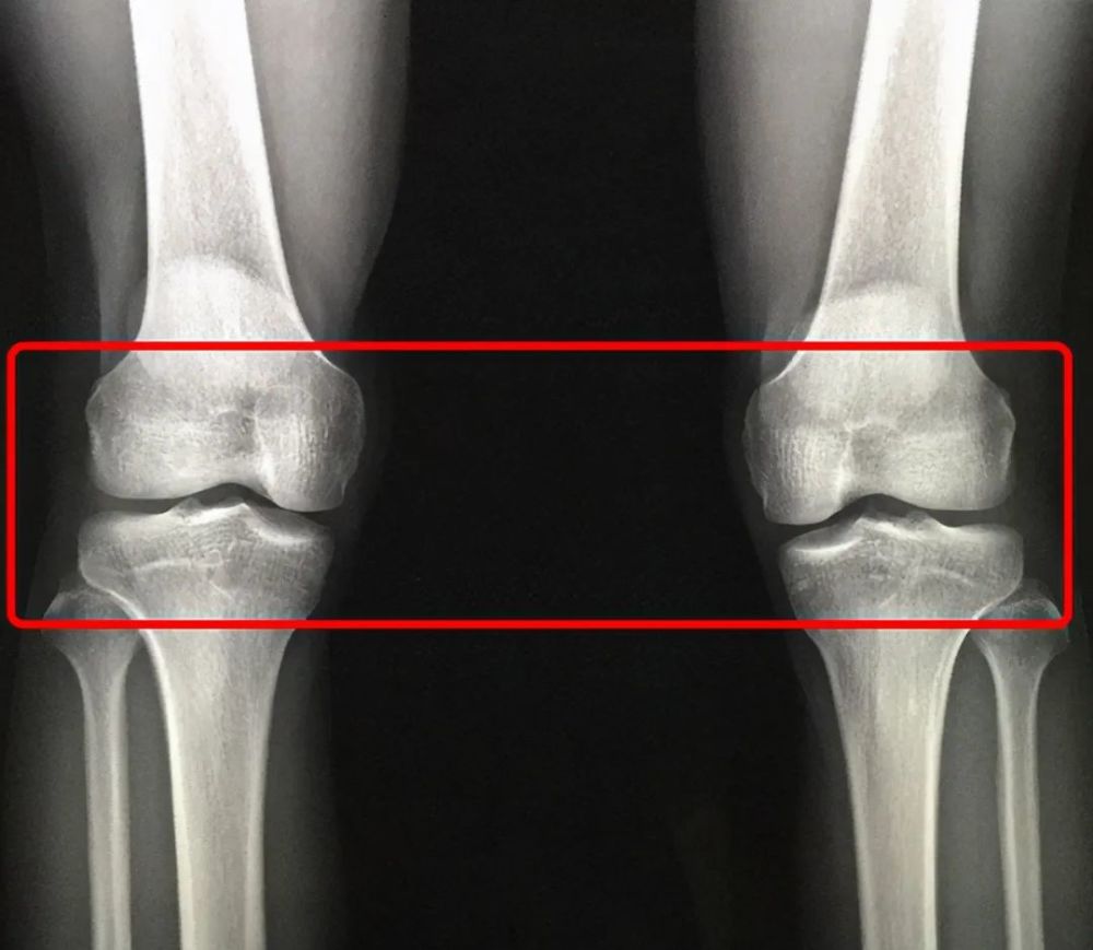14岁男孩身高153,检查后医生:骨骺线已闭合,最多还能长2-3㎝