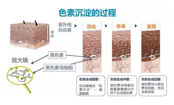 会出现黄褐斑,而大量的黑色素分泌与酶的活性密切相关,即酪氨酸酶