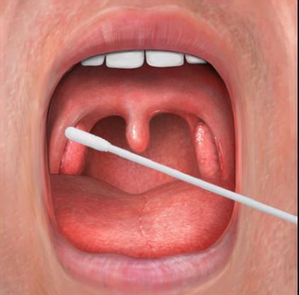 前有口咽拭子鼻咽拭子肛拭子也来了