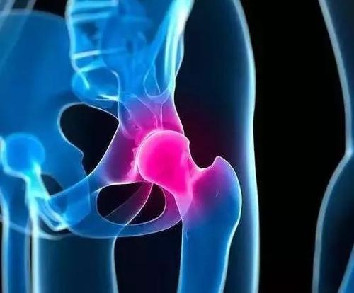 山大二院关节外科运动医学科完成髋关节镜下微创盂唇重建手术