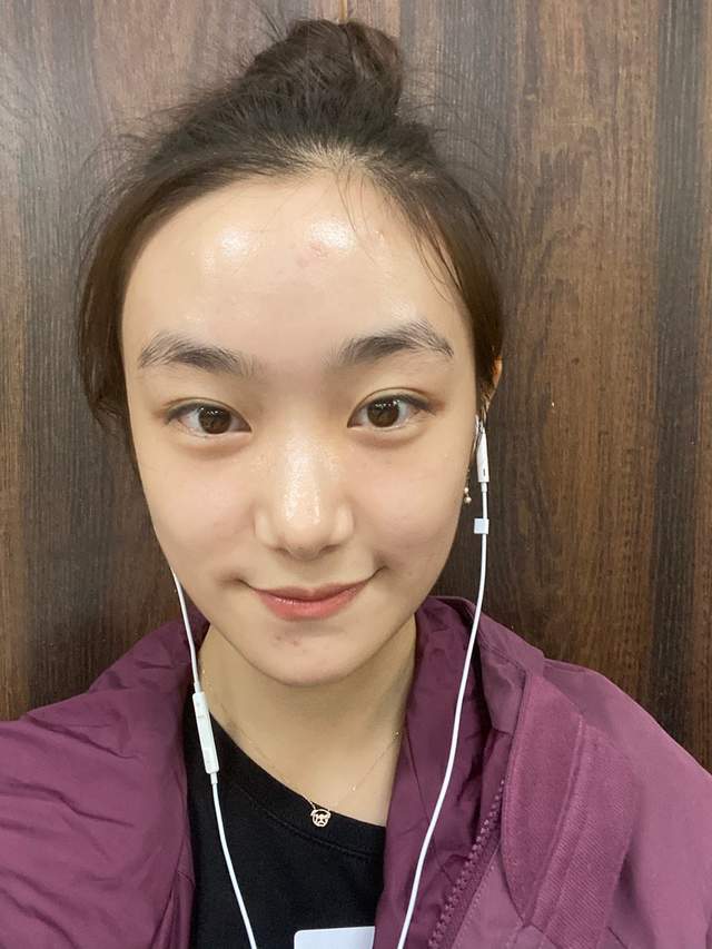 孙俪妹妹晒近照,长一脸青春痘发际线还秃一块,大脑门太像姐姐_腾讯