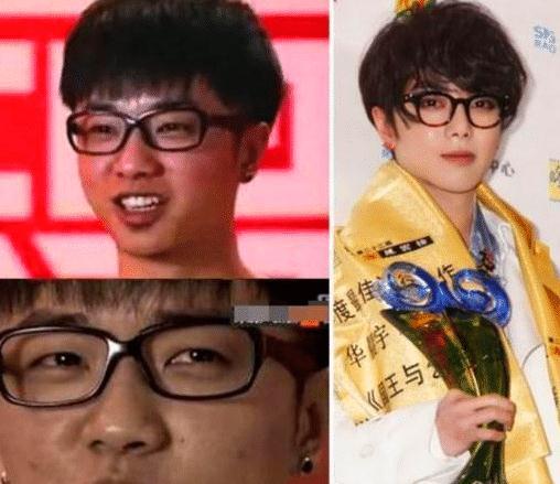 华晨宇整容失败恐成削骨天帝塌鼻梁大饼脸张碧晨不怕遗传给孩子