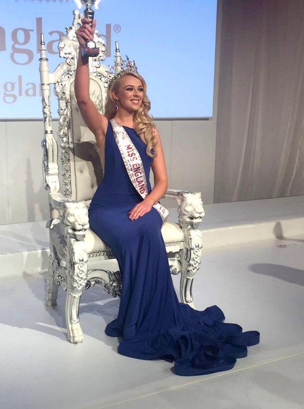 英国小姐选美皇后换上白大褂研究新冠病毒还想角逐环球小姐