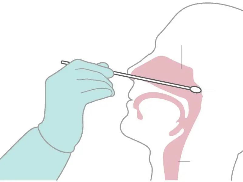 肛拭子是什么学校检查肛拭子