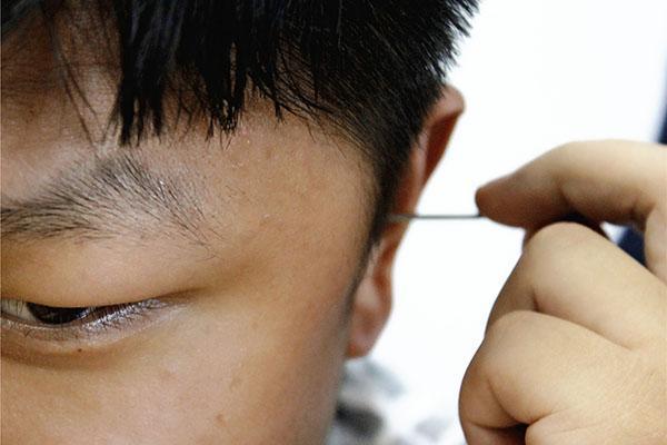 千万别用耳勺挖耳屎3个危害影响大耳朵发痒该如何护理