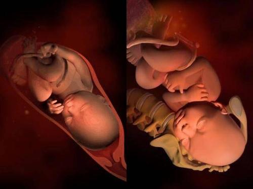 孕妇入盆对比照图片图片