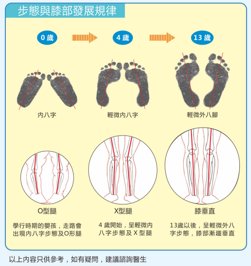 儿童足部发育过程图图片