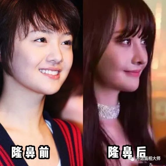 为什么?杨采钰即使鼻基底凹陷也不差贵气?_腾讯新闻