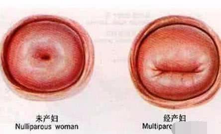 现在的女性越来越注重产后恢复,但是体型恢复得再好,宫颈都是不可能