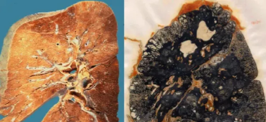 顶流华晨宇家里有矿,有厂,还有矽肺病村民_腾讯新闻