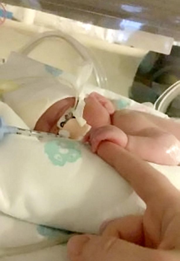 英国宝宝早产,体重不到2斤,如今又成功挺过新冠及败血症