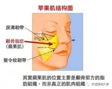 而这块决定你年轻与否的苹果肌,是由颧肌和颧脂肪垫组成.