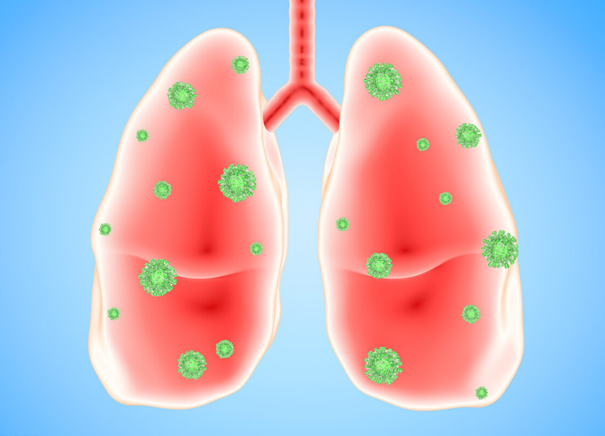 肺部|1种食物是“养肺王”，平时敞开吃，给肺来个“大扫除”
