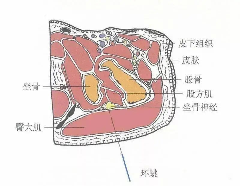 向下則投影在坐骨結節與股骨大轉子連線中點稍內側