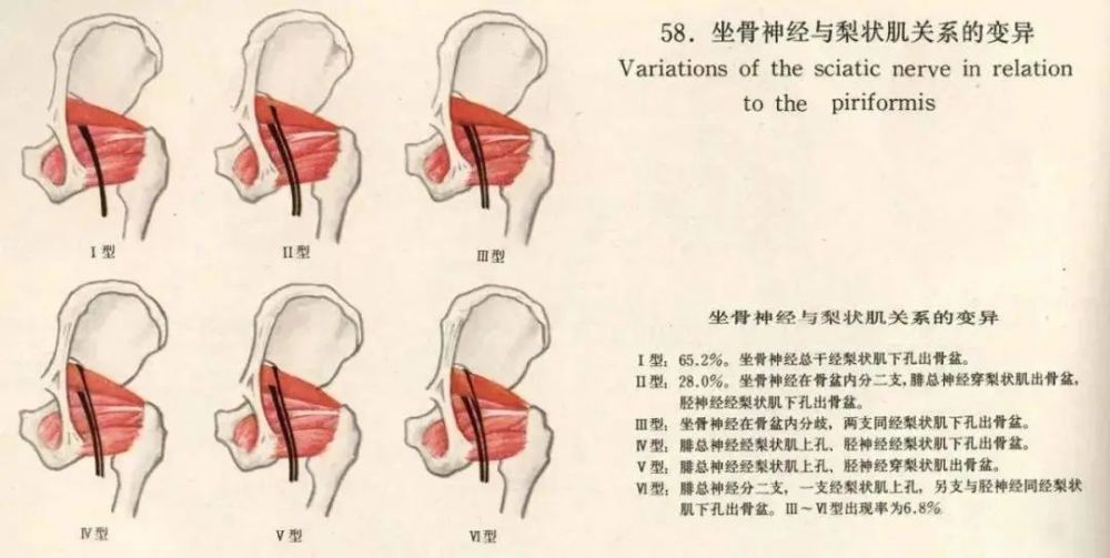 梨狀肌下孔穿出骨盆之後走行在臀大肌深面,在坐骨結節和大轉子之間